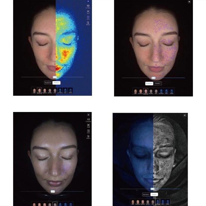 diagnóstico facial con IA